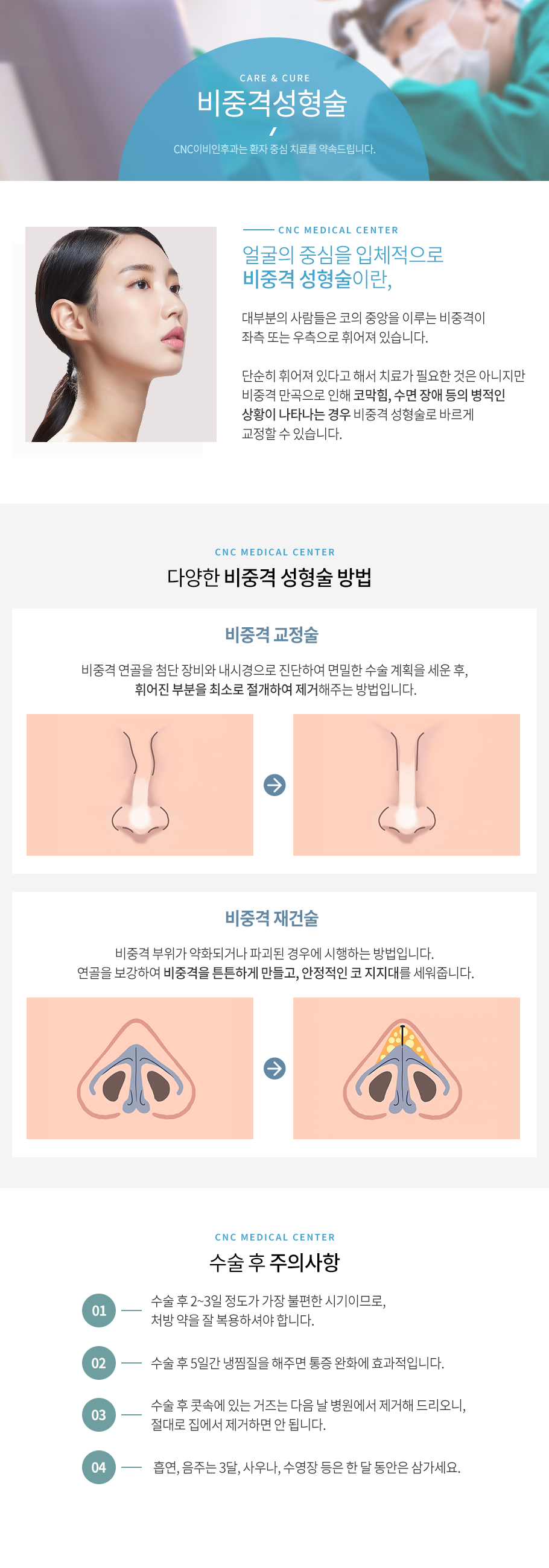 비중격성형술