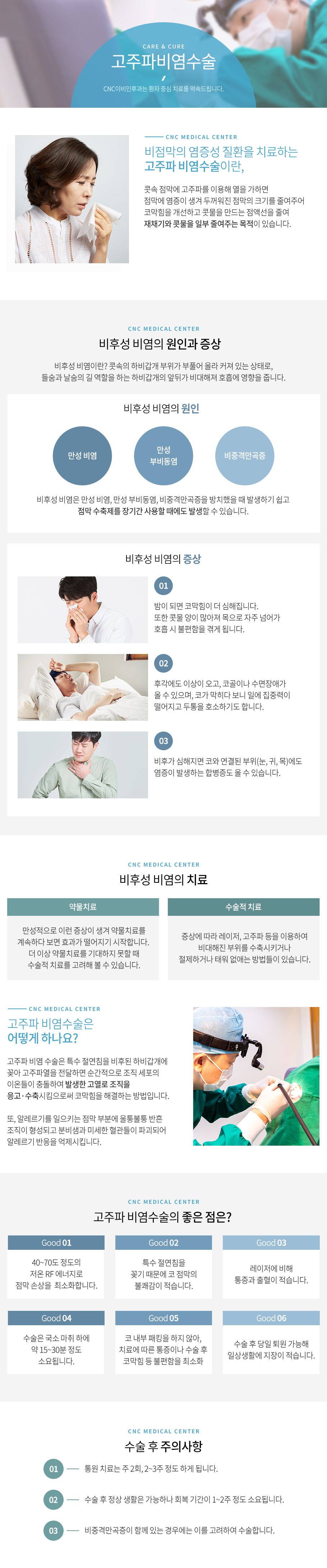 고주파비염수술