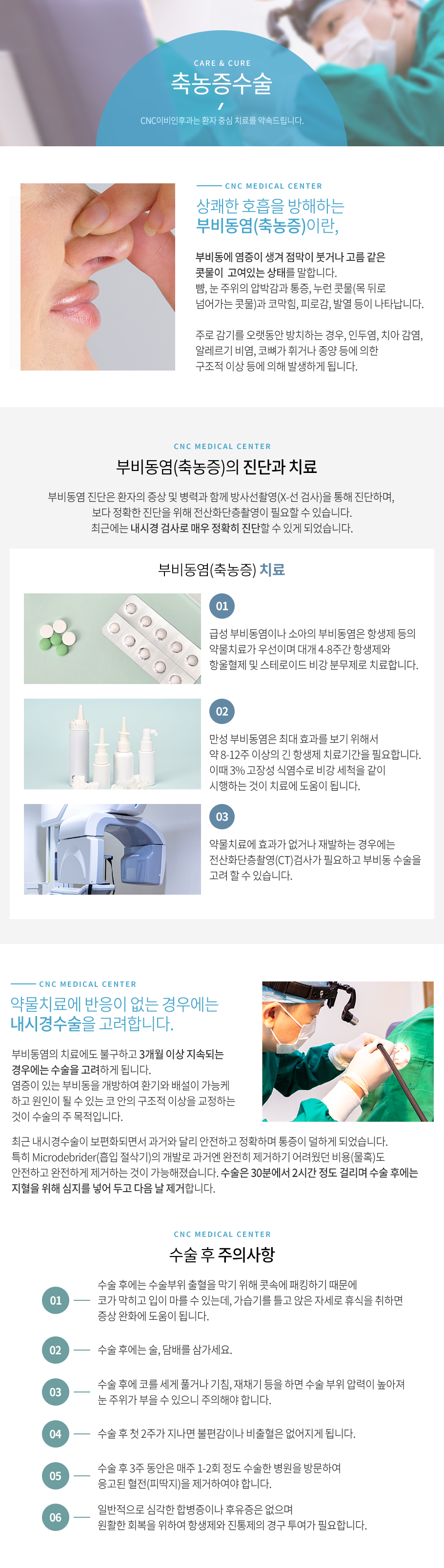 축농증수술